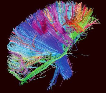 Muse odhalili obal nové desky, vyjde v září